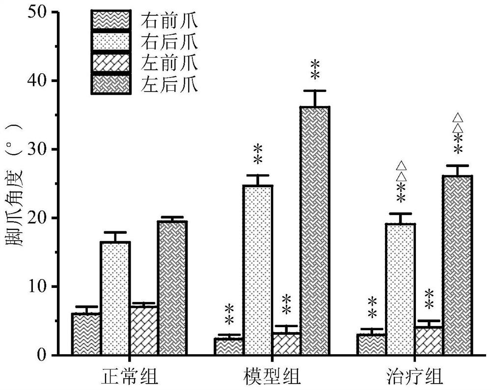 Application of traditional Chinese medicine composition in preparation of medicine for preventing or treating nervous system diseases