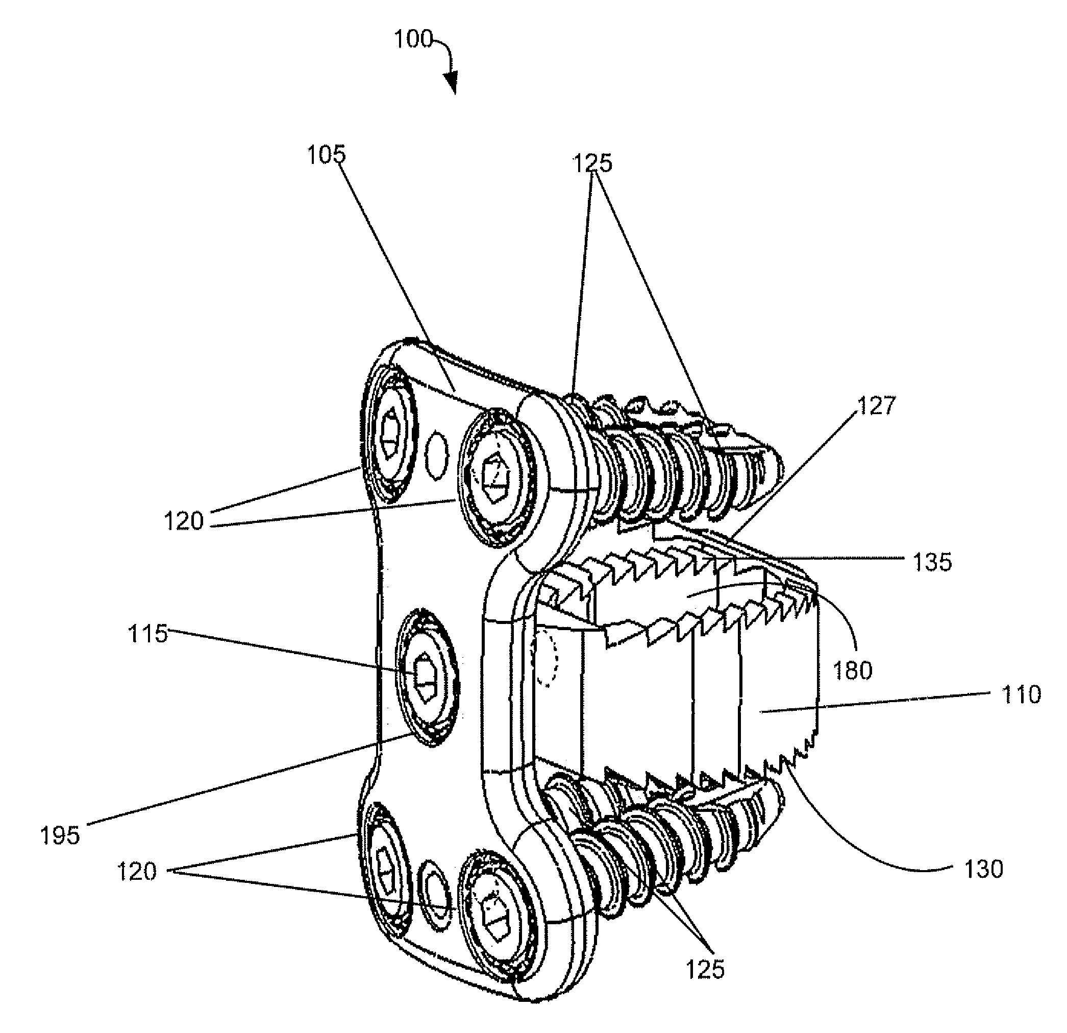 Spinal interbody system and method