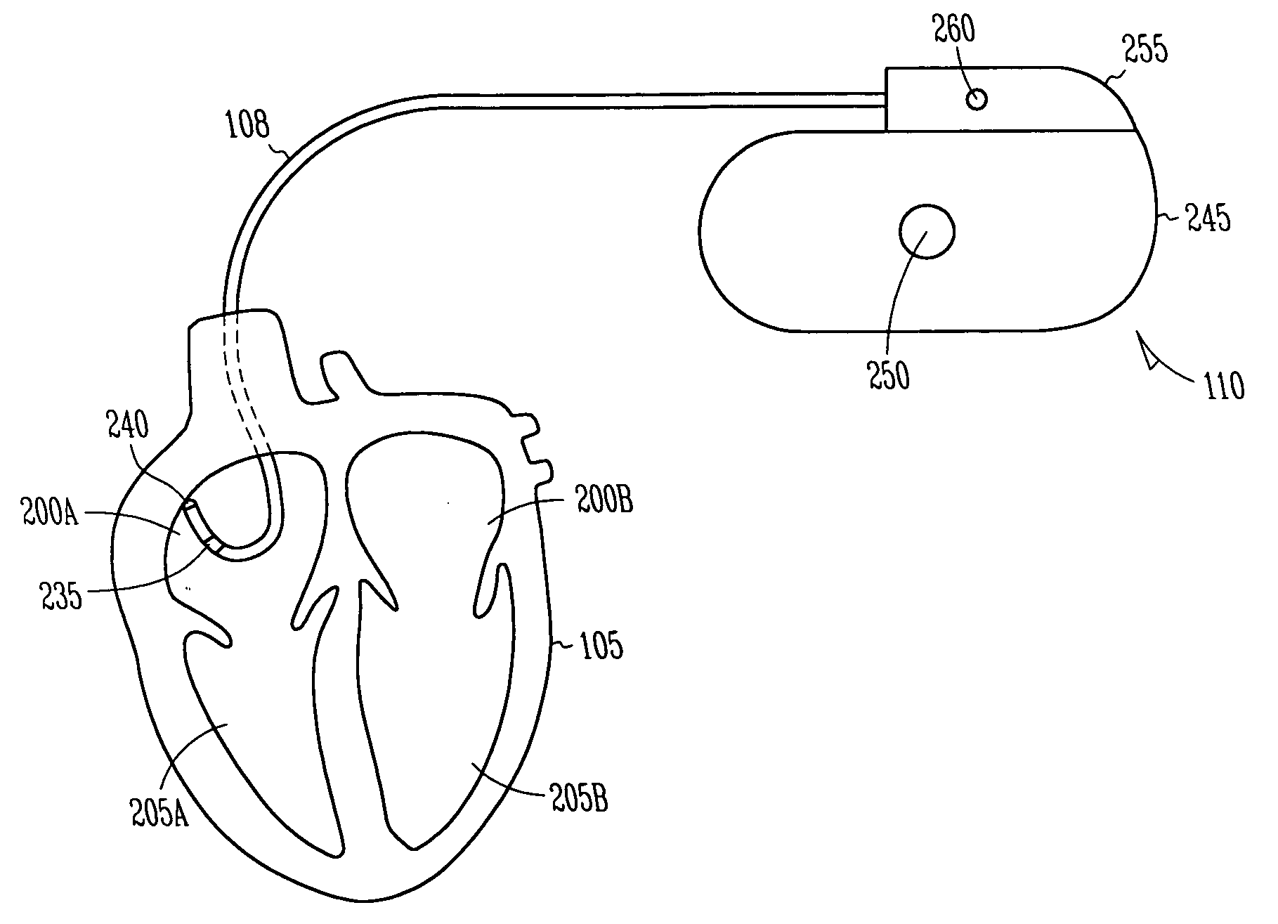 Cardiac stimulation device for sinus rate modulation