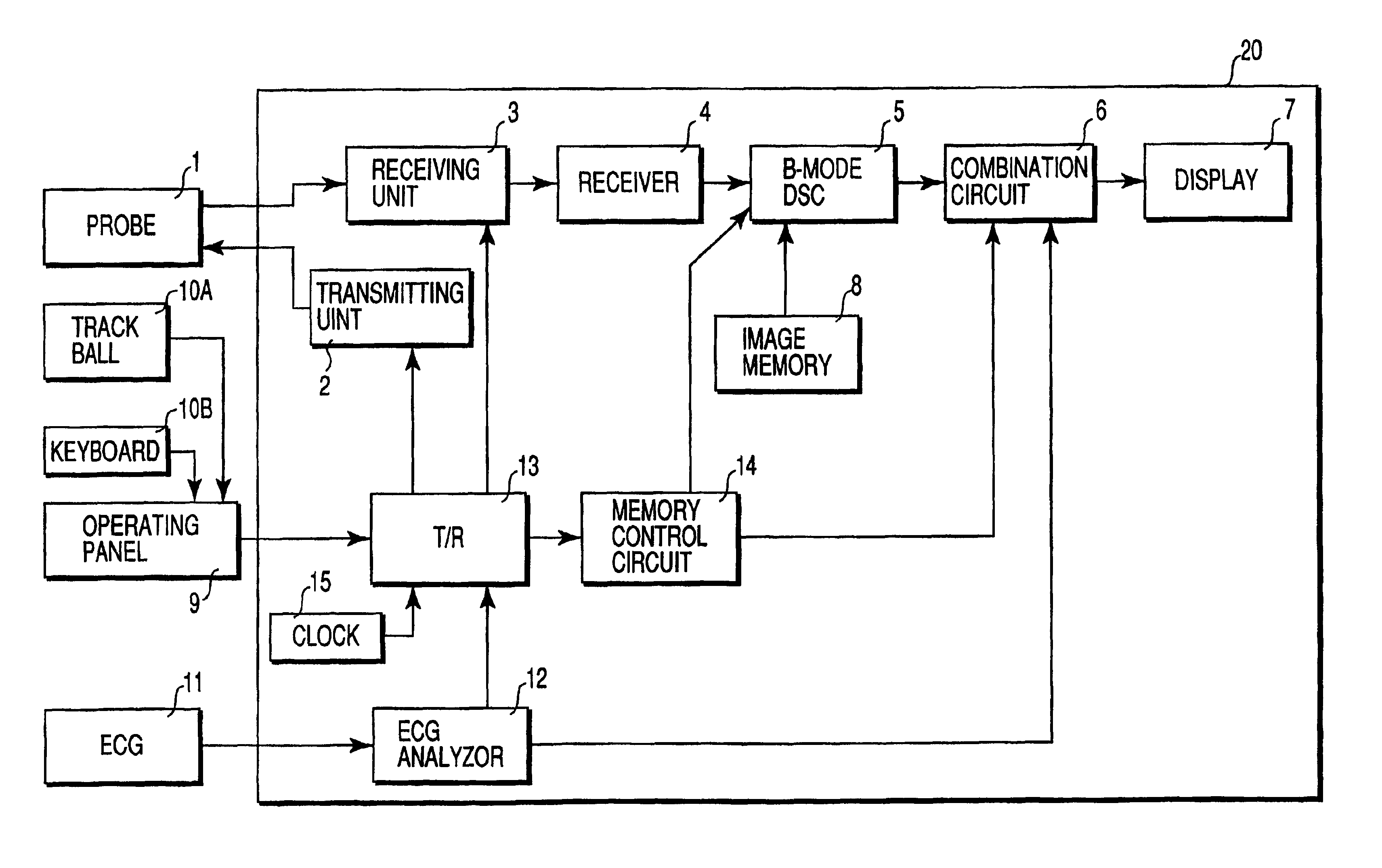 Ultrasound diagnostic apparatus