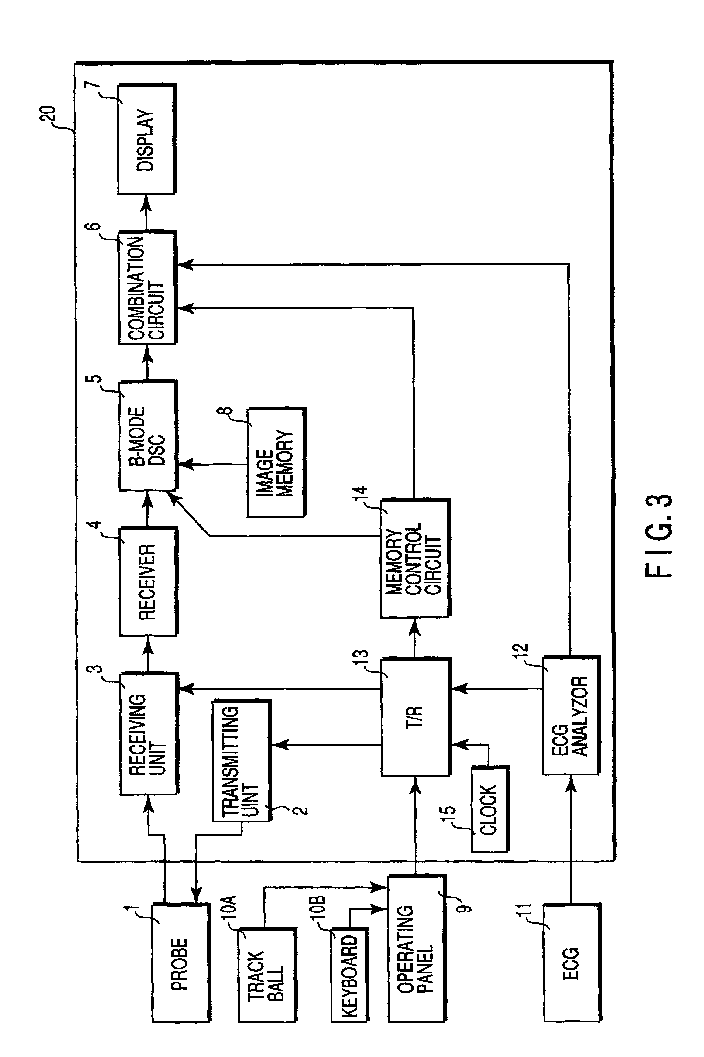 Ultrasound diagnostic apparatus