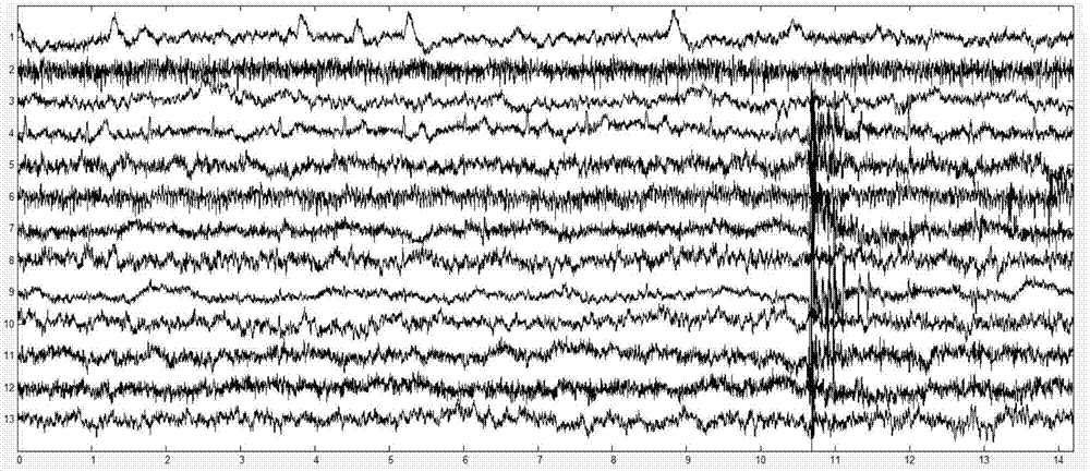 Combatant state monitoring system based on electroencephalogram signals