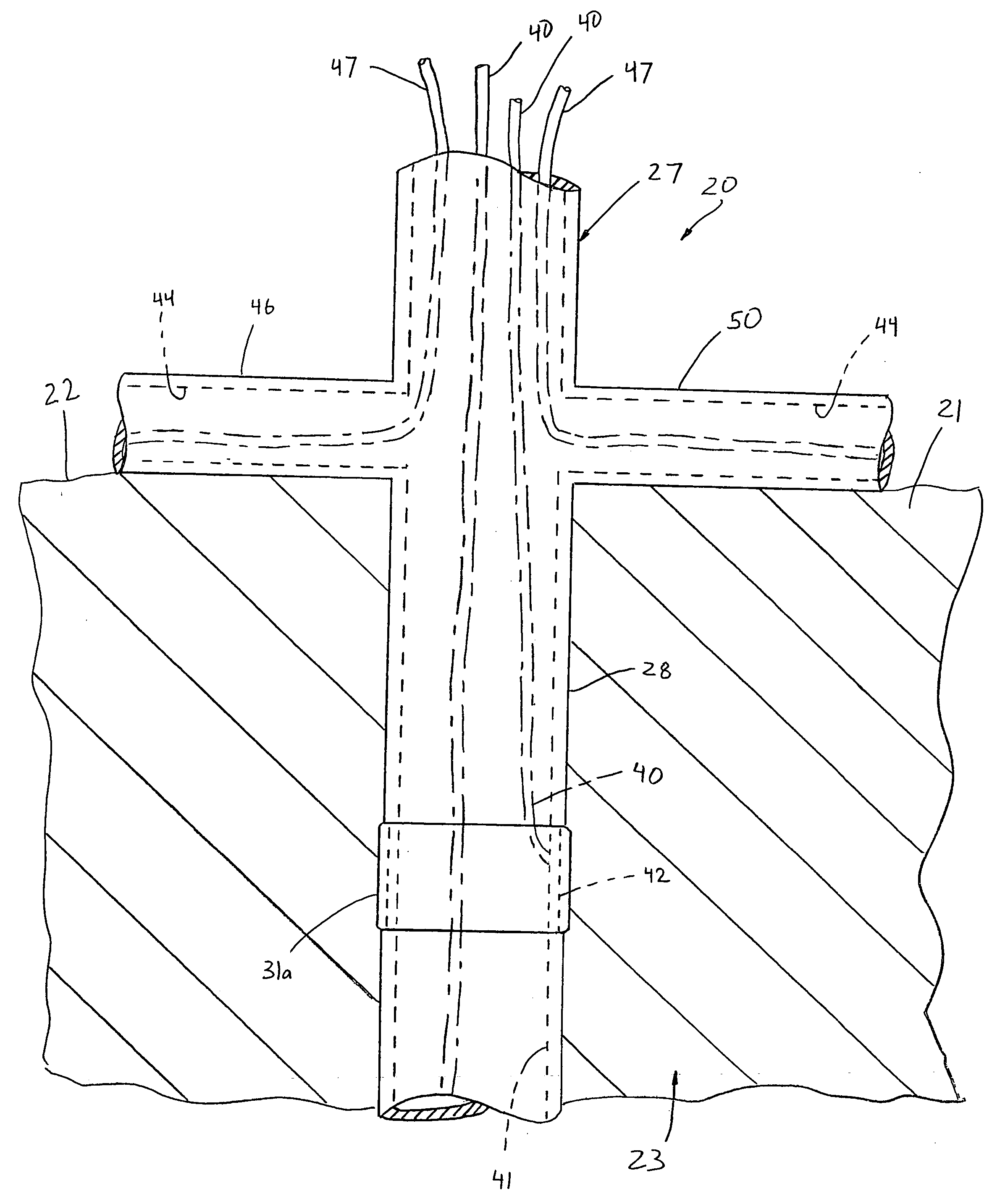 Apparatus and method for assessing tissue ablation transmurality