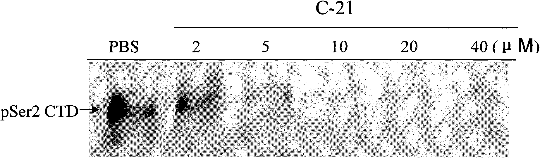 Application of N-(thiofuran-2) pyrazolo (1, 5-a) pyridine-3-formanides compounds for preparing antineoplastic