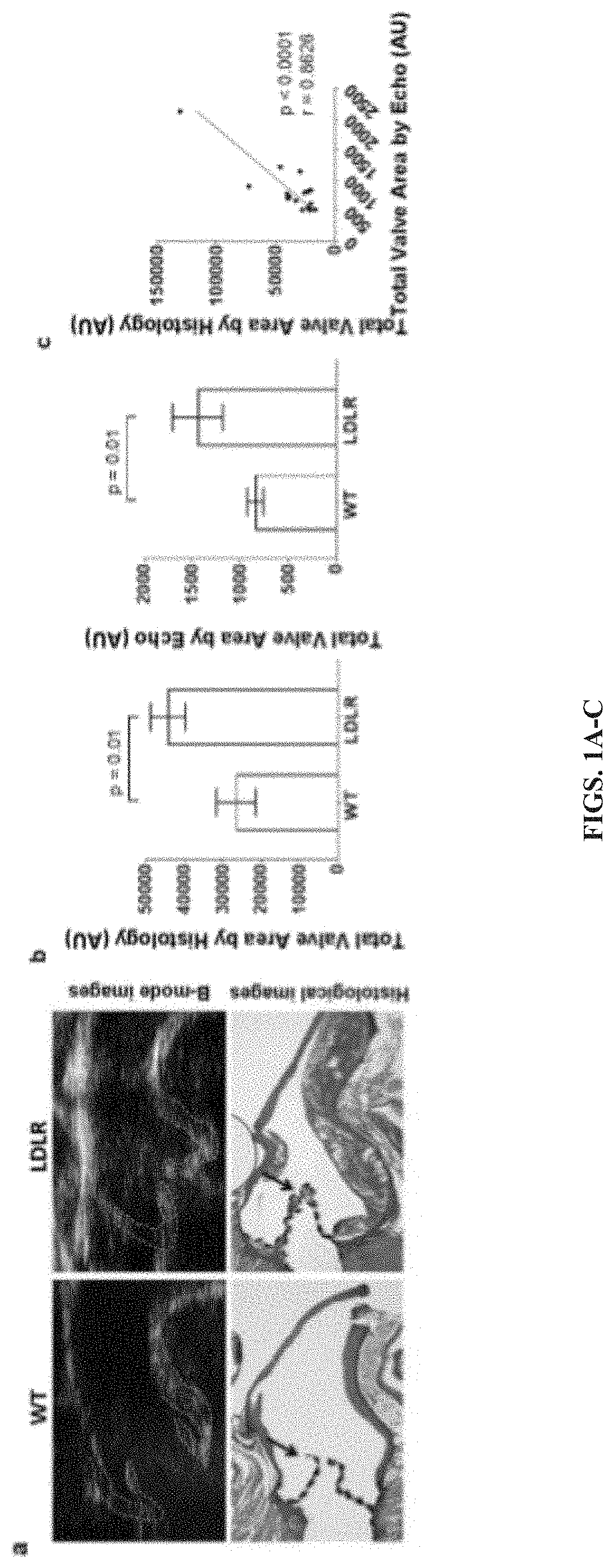 N-acetylcysteine attenuates aortic stenosis progression by inhibiting shear-mediated tgf-beta activation and signaling