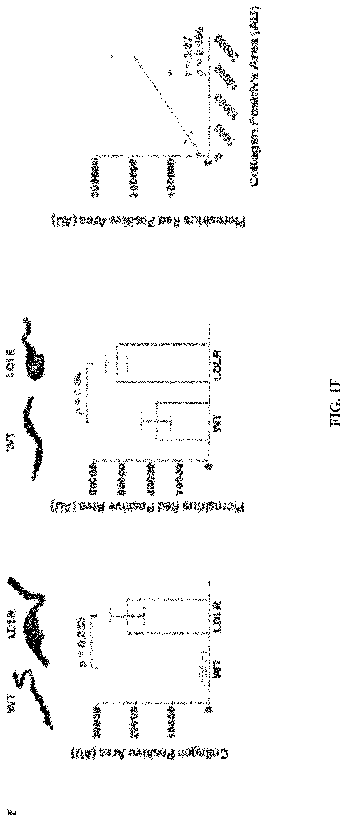 N-acetylcysteine attenuates aortic stenosis progression by inhibiting shear-mediated tgf-beta activation and signaling