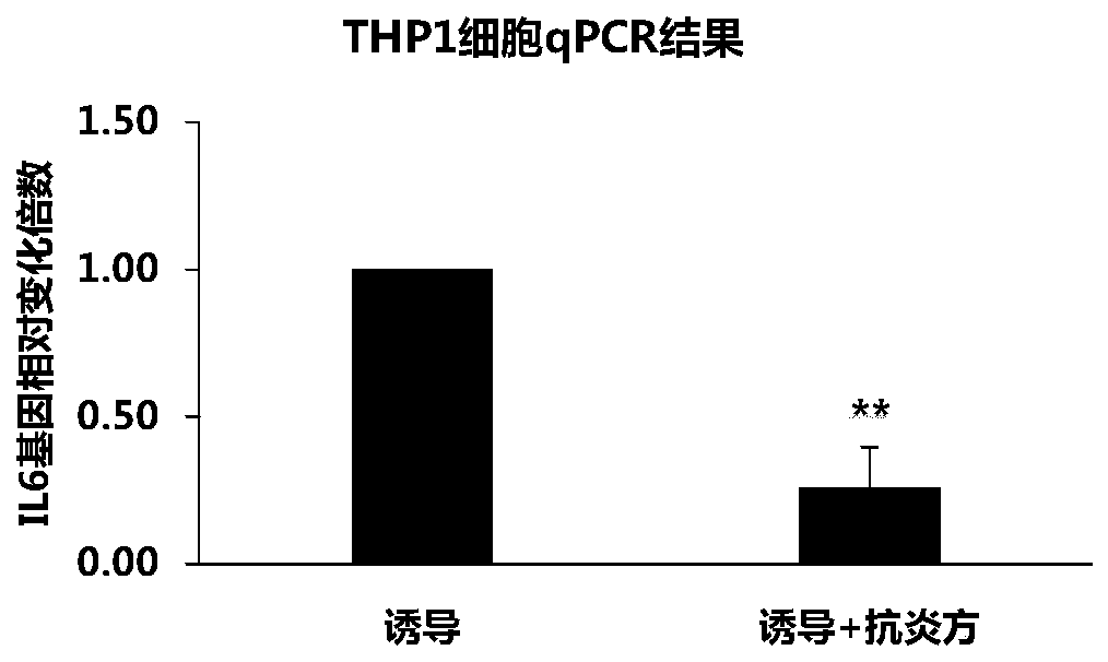 Traditional Chinese medicine composition and application thereof in preparing drugs for treating rhinitis