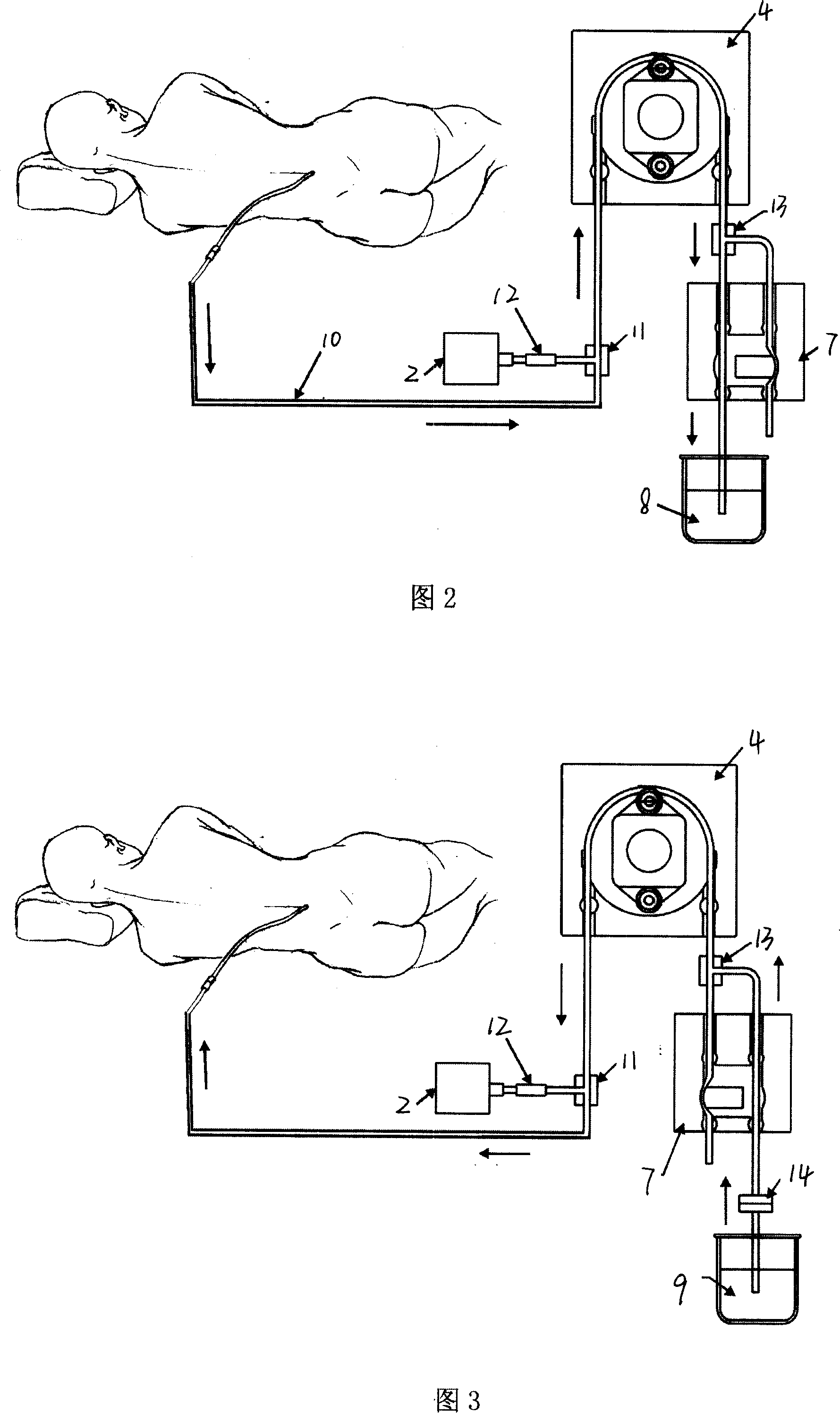 Cerebrospinal fluid external displacement instrument