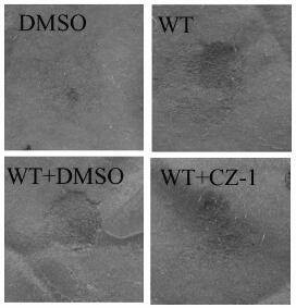 Application of 2-methoxyphenylpropionic acid compound in prevention and/or treatment of plant diseases