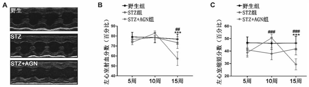 A method for constructing a type 2 diabetic mouse model of rapid heart failure