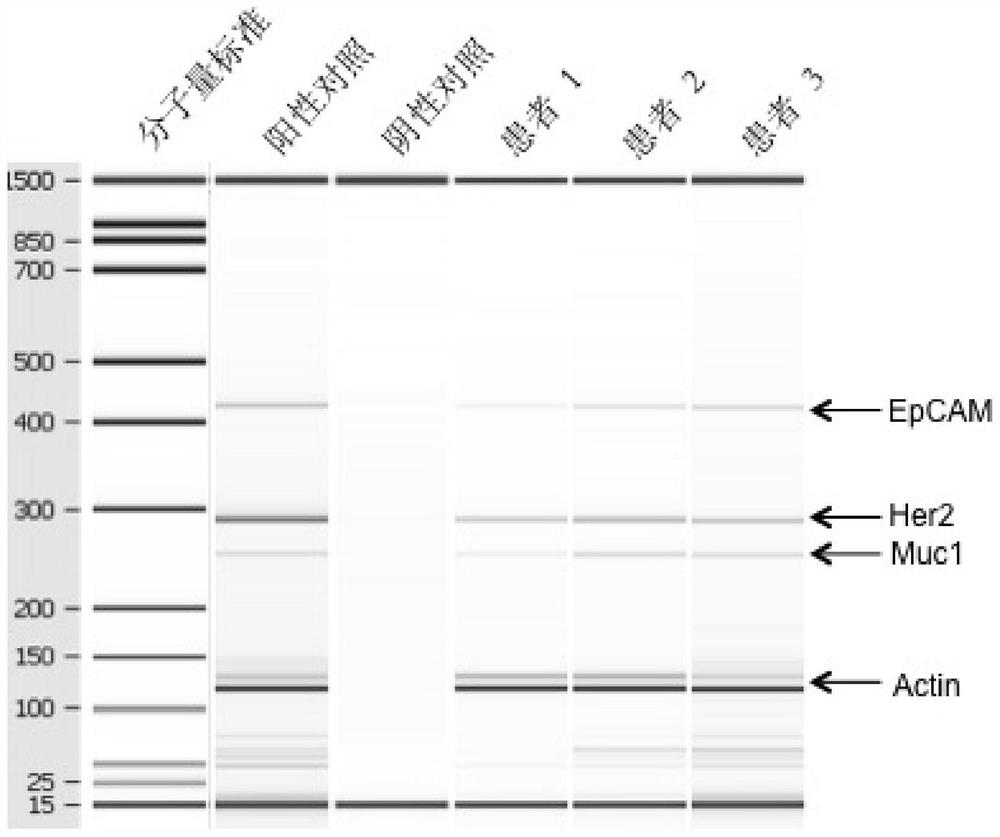 A kit for detecting markers of ovarian cancer cells in peripheral blood