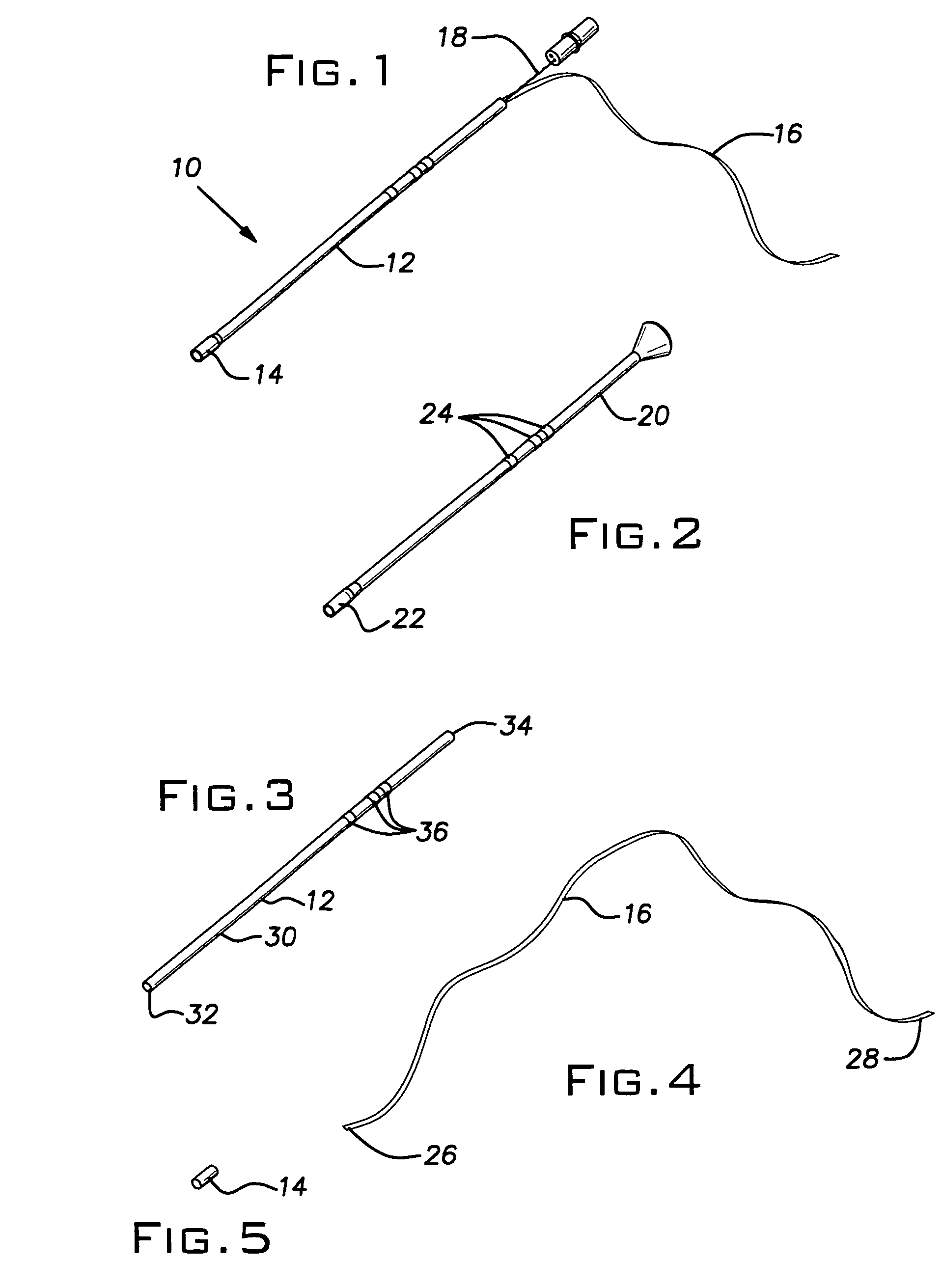 Bridle catheter with umbilical tape