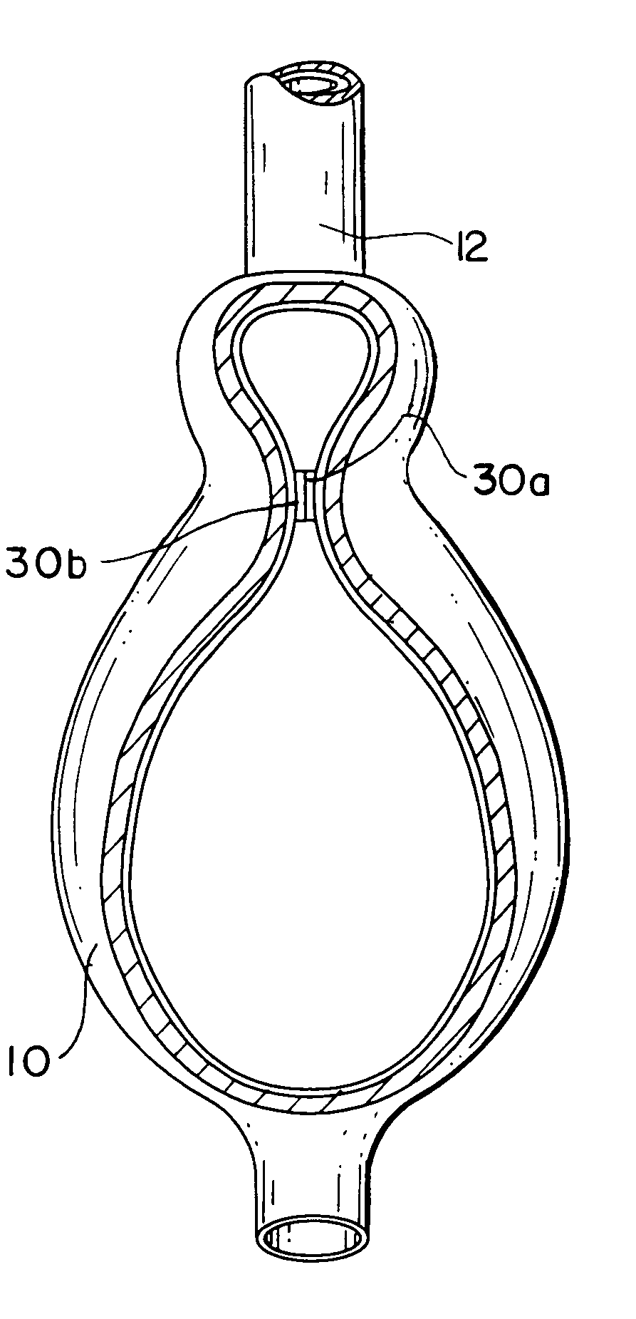 Stomach reduction methods and apparatus