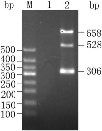 Primer set, chip and kit for genotyping detection of alpha thalassemia and beta thalassemia