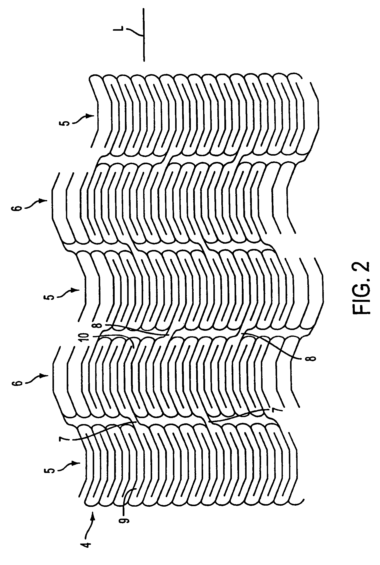 Apparatus for a stent having an expandable web structure