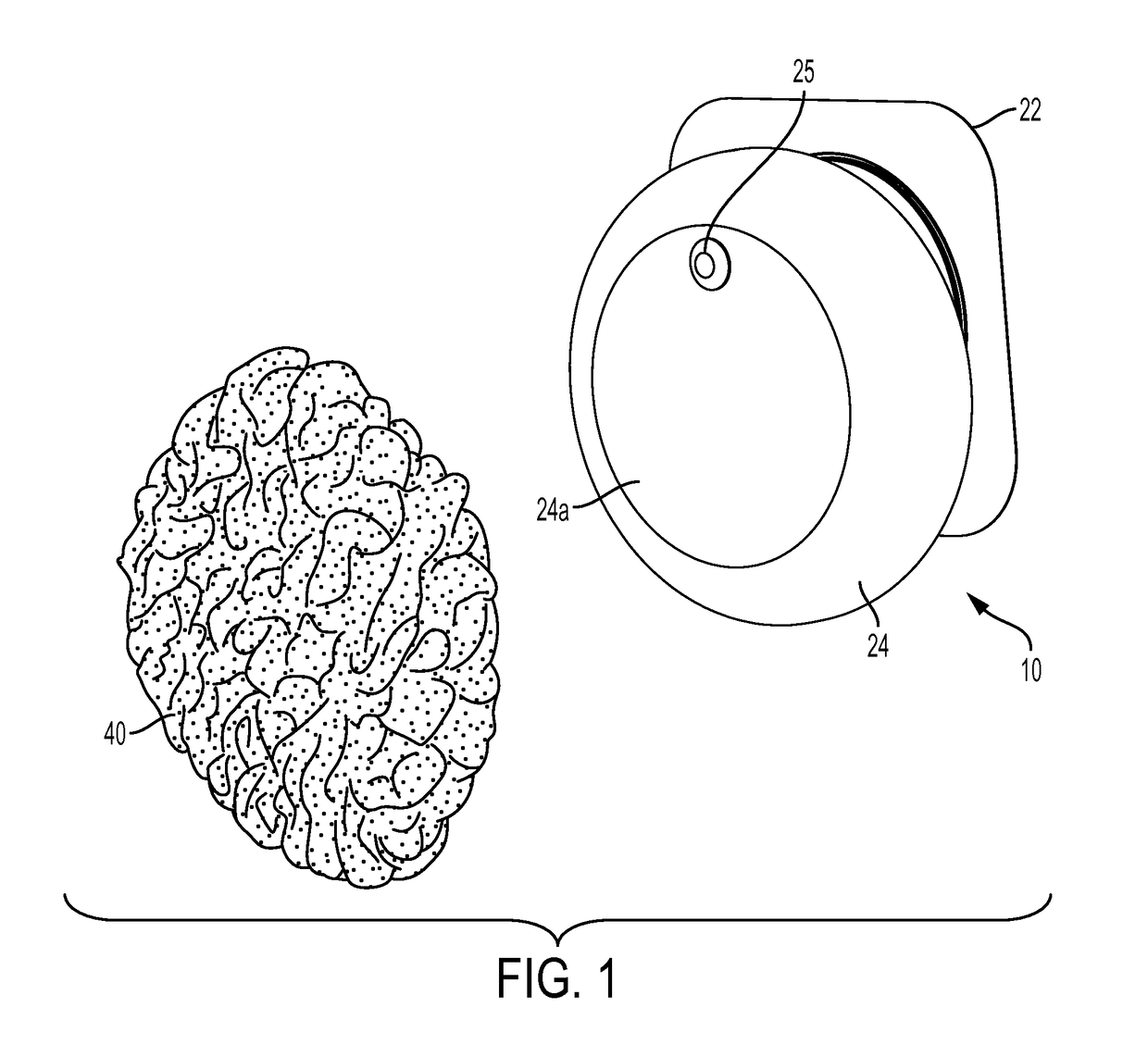 Ostomy appliance