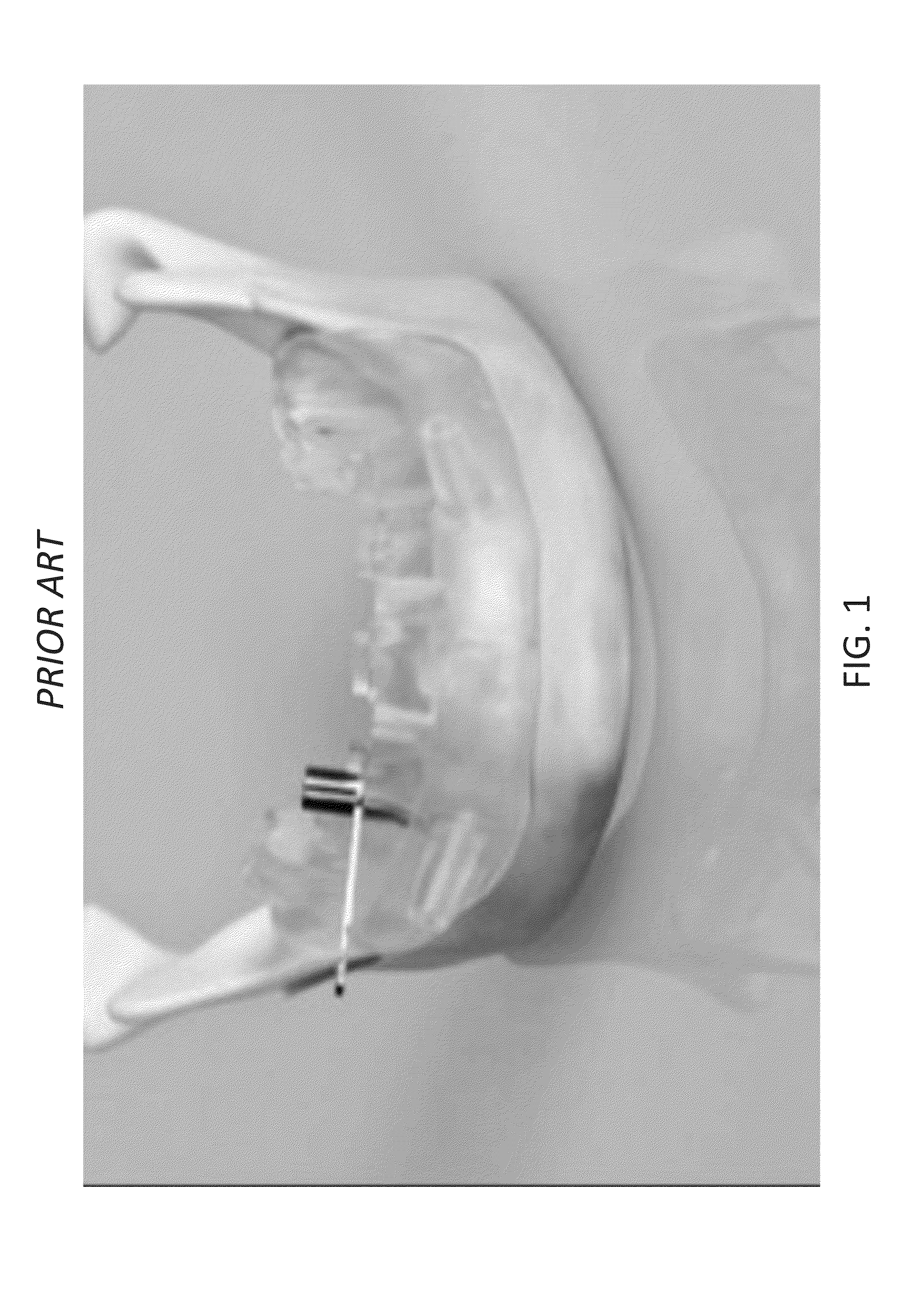 Dental device comprising surgical template and false teeth set and related methods