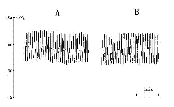 Device of extracorporally imitating blood pressure fluctuation rising and application method and application