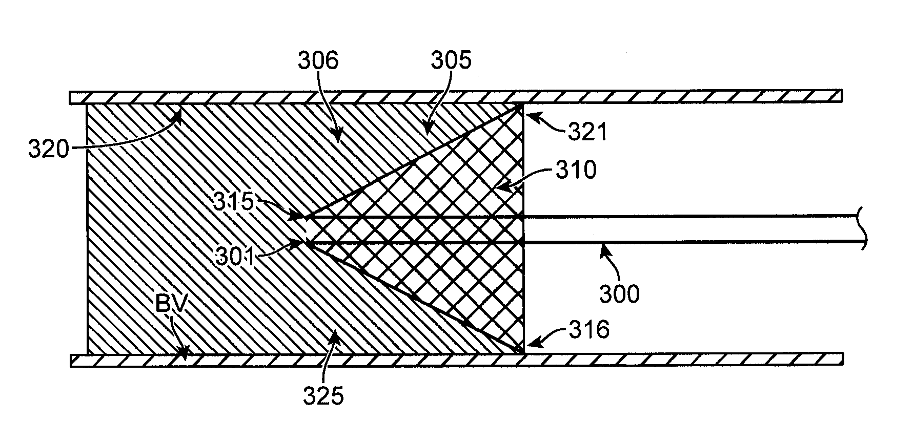 Integrated embolic protection devices