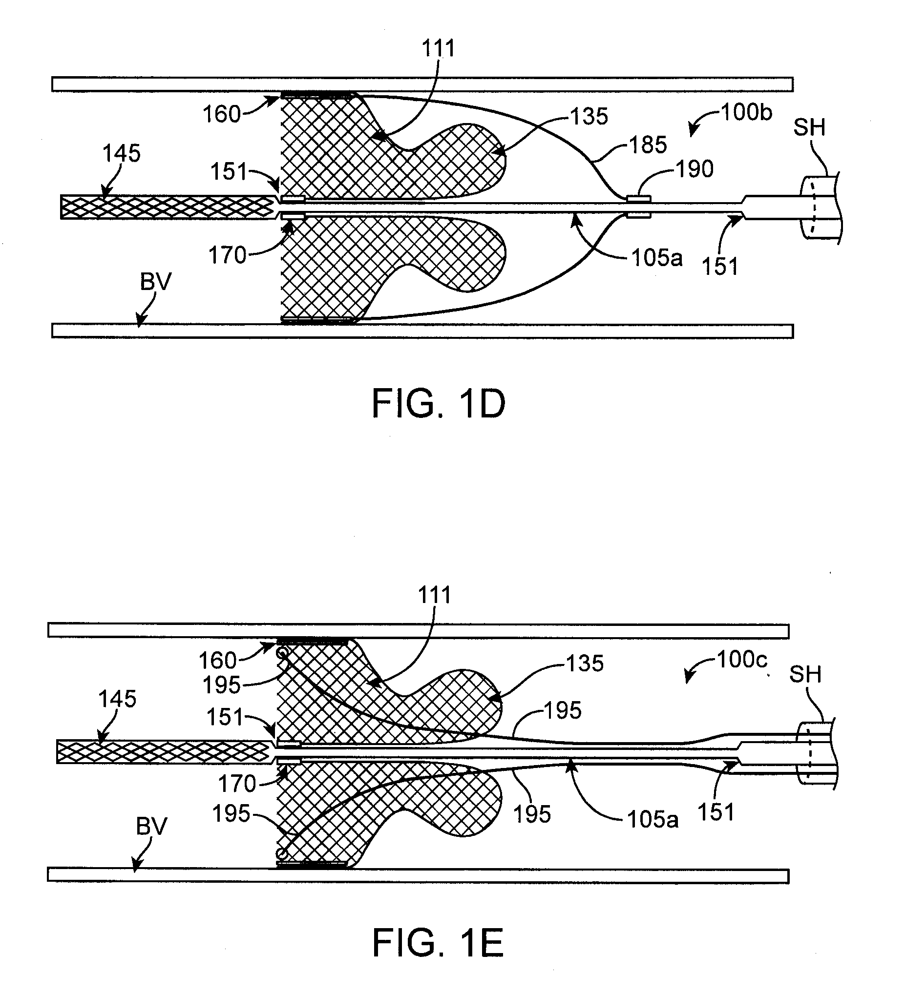 Integrated embolic protection devices