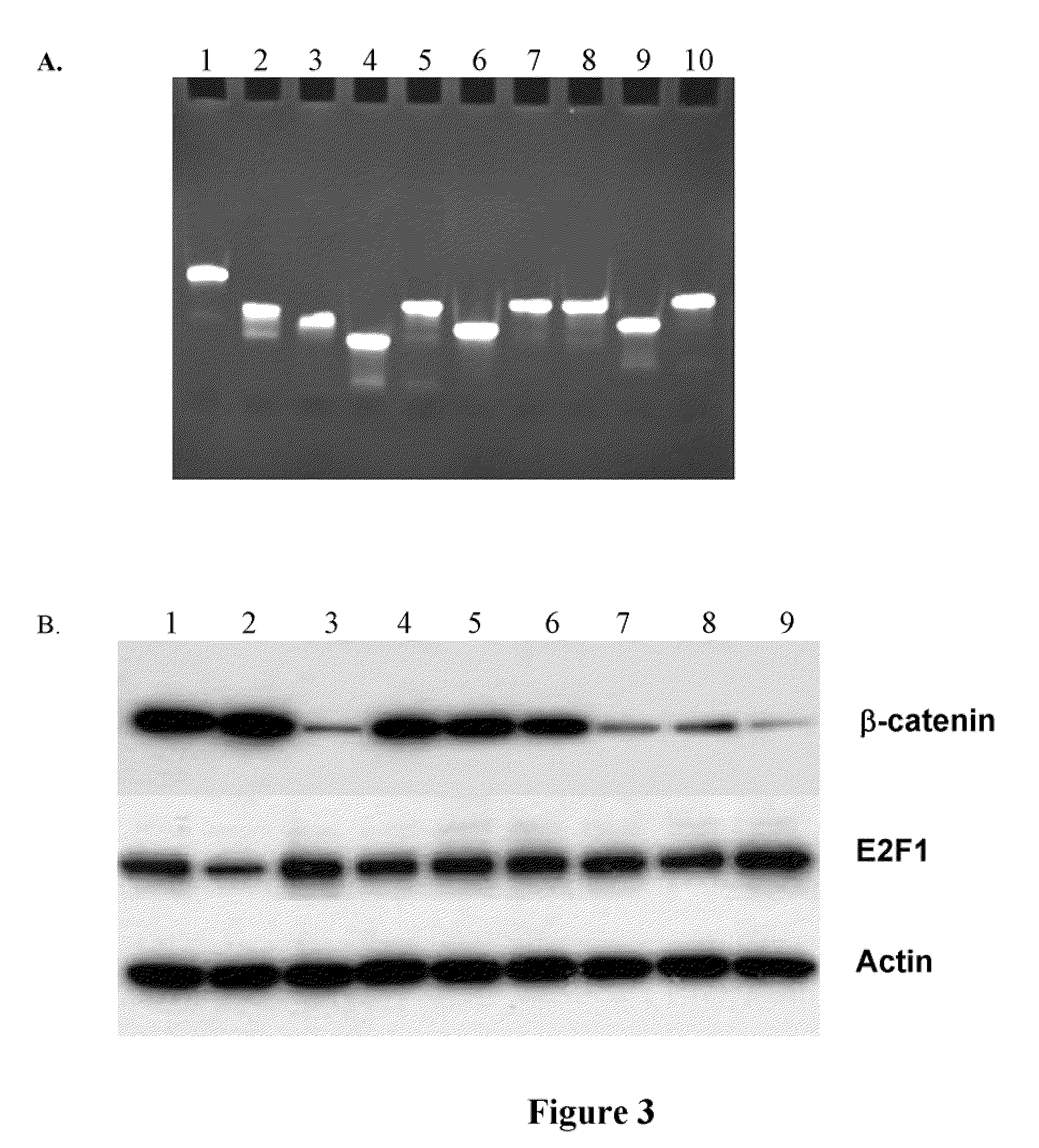 Compositions of asymmetric interfering RNA and uses thereof