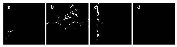 Chitosan gel haemostatic material and preparation method thereof