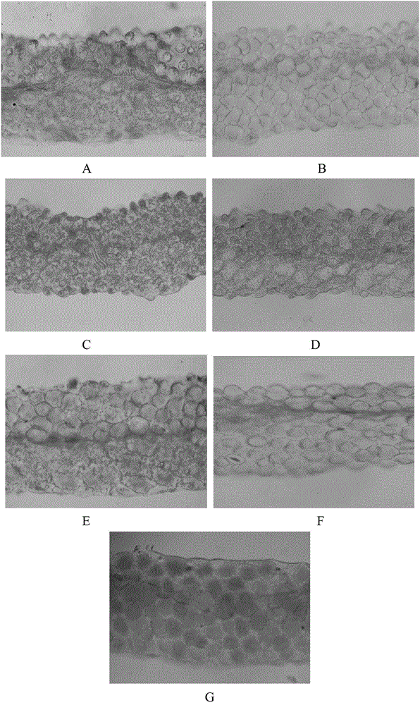 Application of inhibiting accumulation of xantheins and accumulating lycopene and anthocyanin in preparation of Brassica plants with red pedals