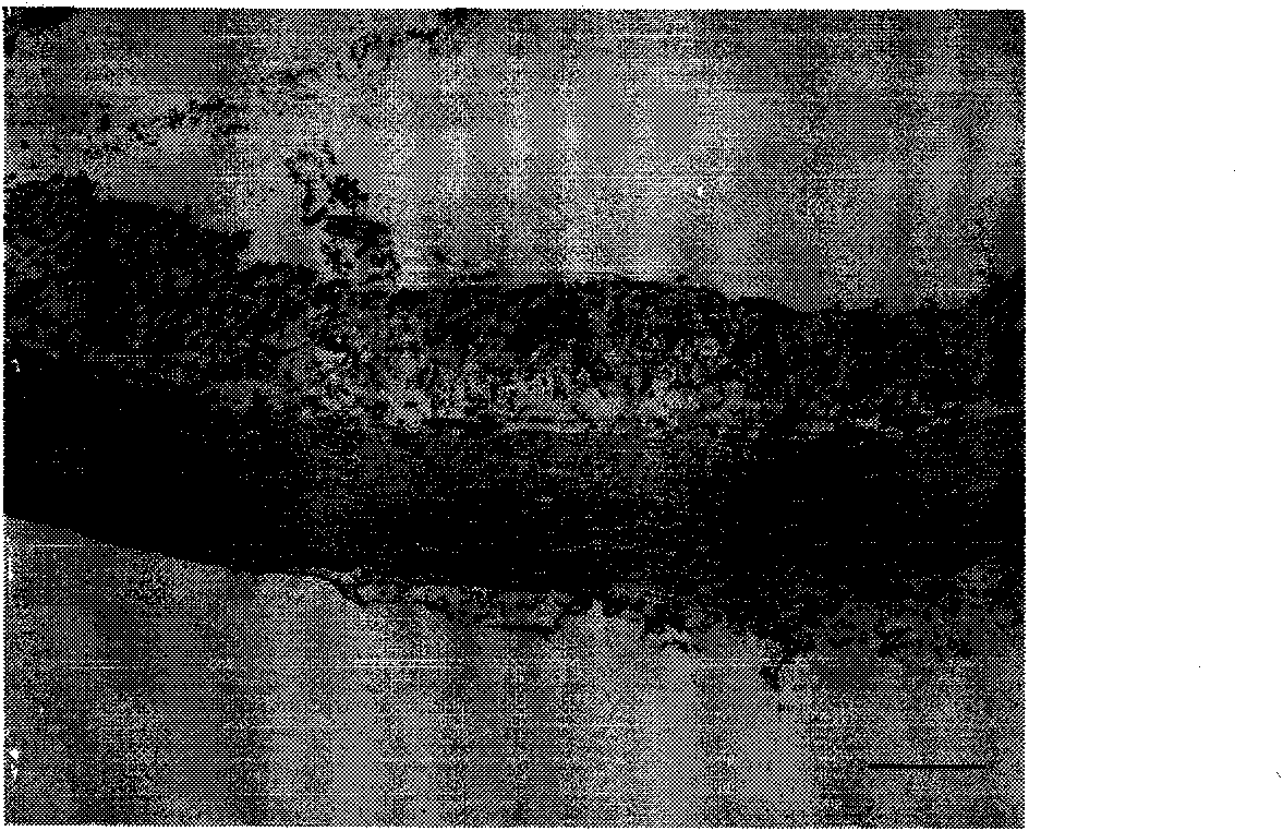 Drug combination containing raloxifene and application thereof