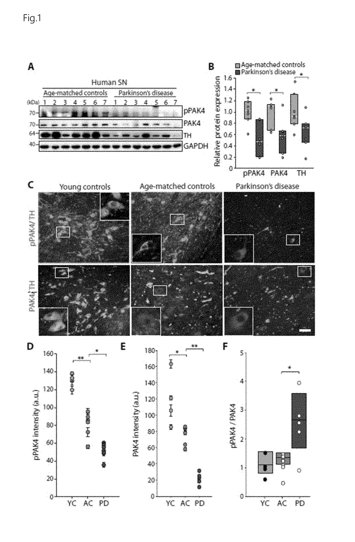 Use of pak4 and crtc1 for treatment or diagnosis of brain degenerative disease