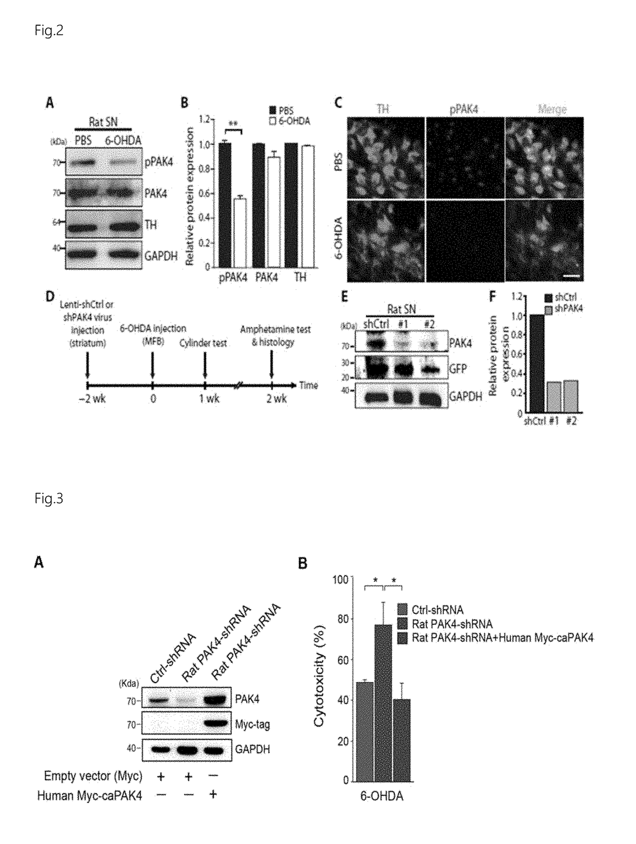 Use of pak4 and crtc1 for treatment or diagnosis of brain degenerative disease