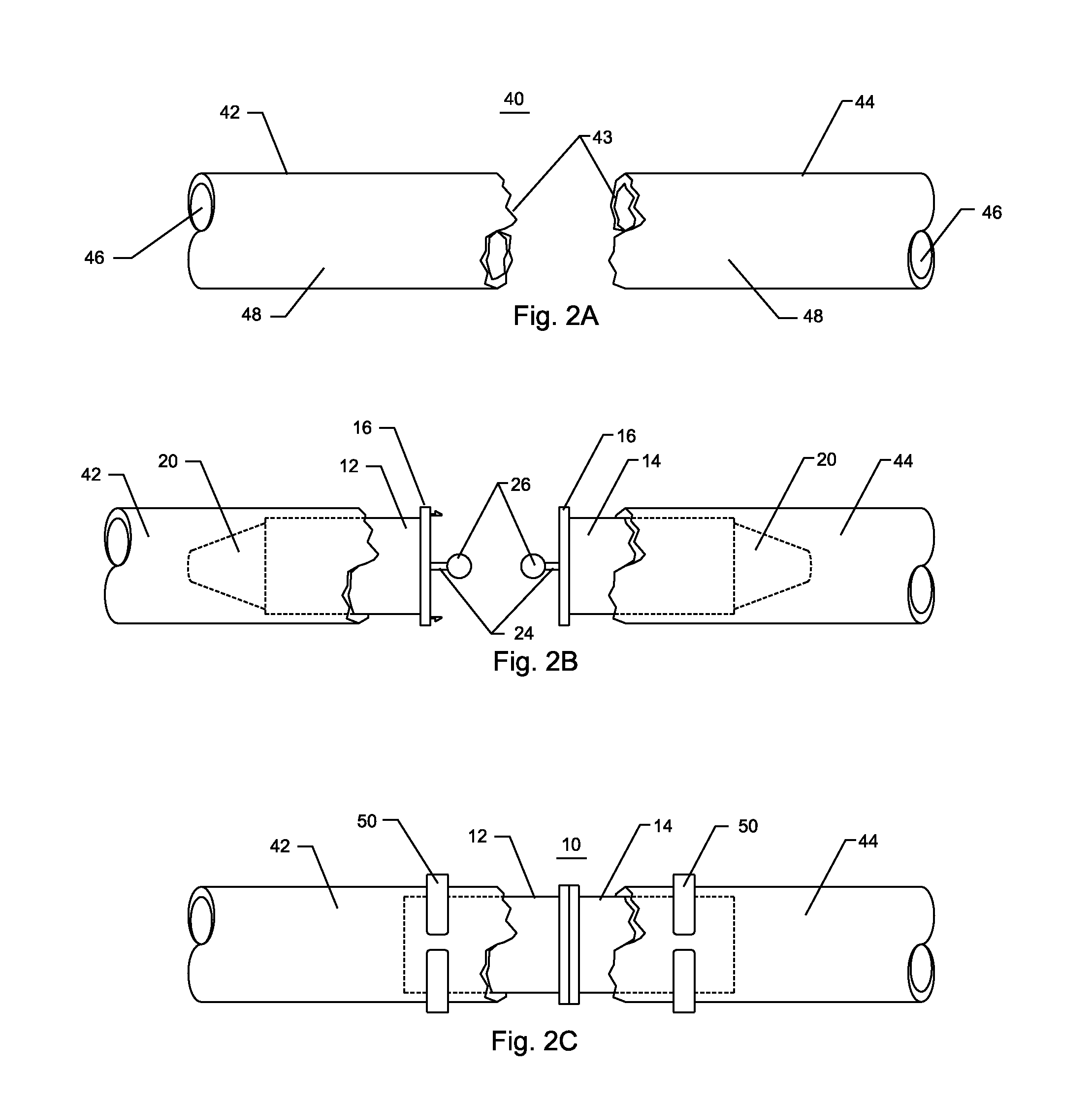 Method and device for temporary emergency vessel anastomoses