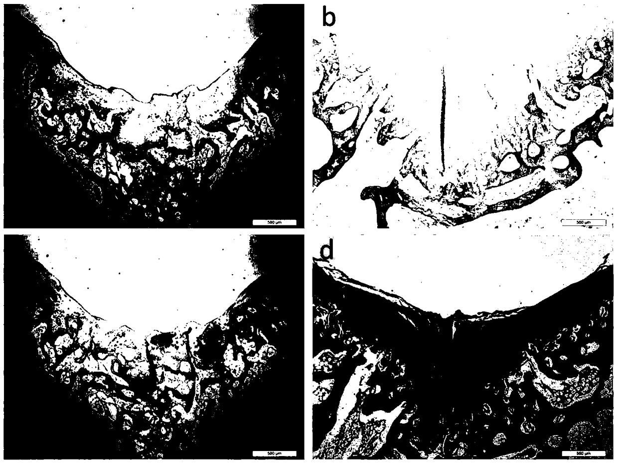 A collagen-based cartilage scaffold