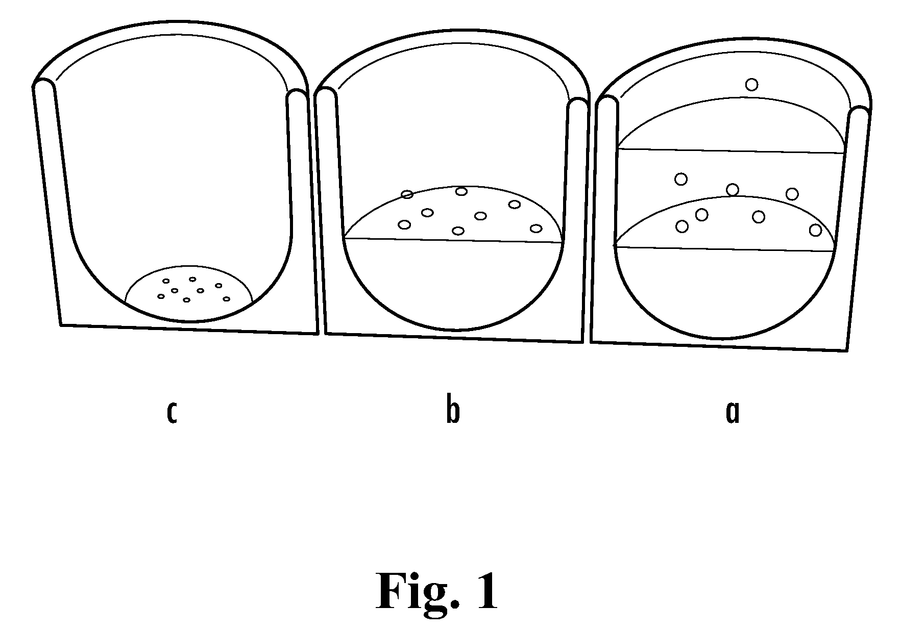 Loadable Polymeric Particles for Therapeutic Use in Erectile Dysfunction and Methods of Preparing and Using the Same