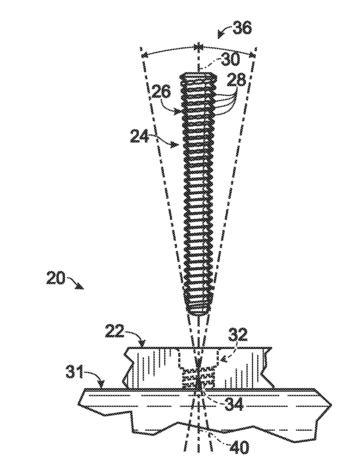 Fastener with serrated thread for attachment to a bone plate at a selectable angle