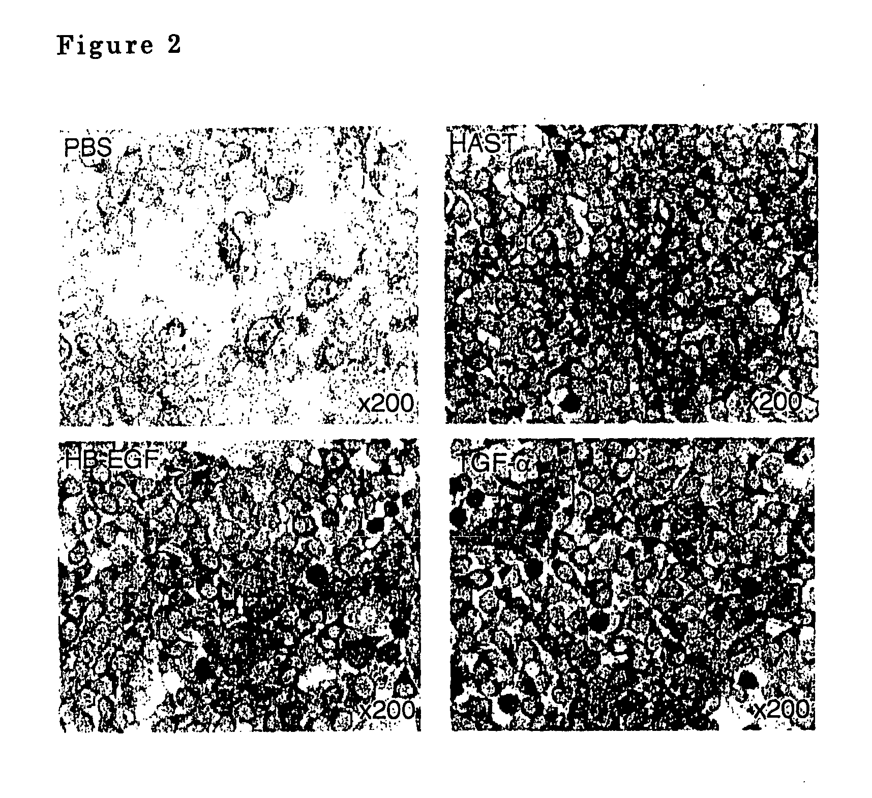 Airway-specific trypsin-like enzymes and method of using the same