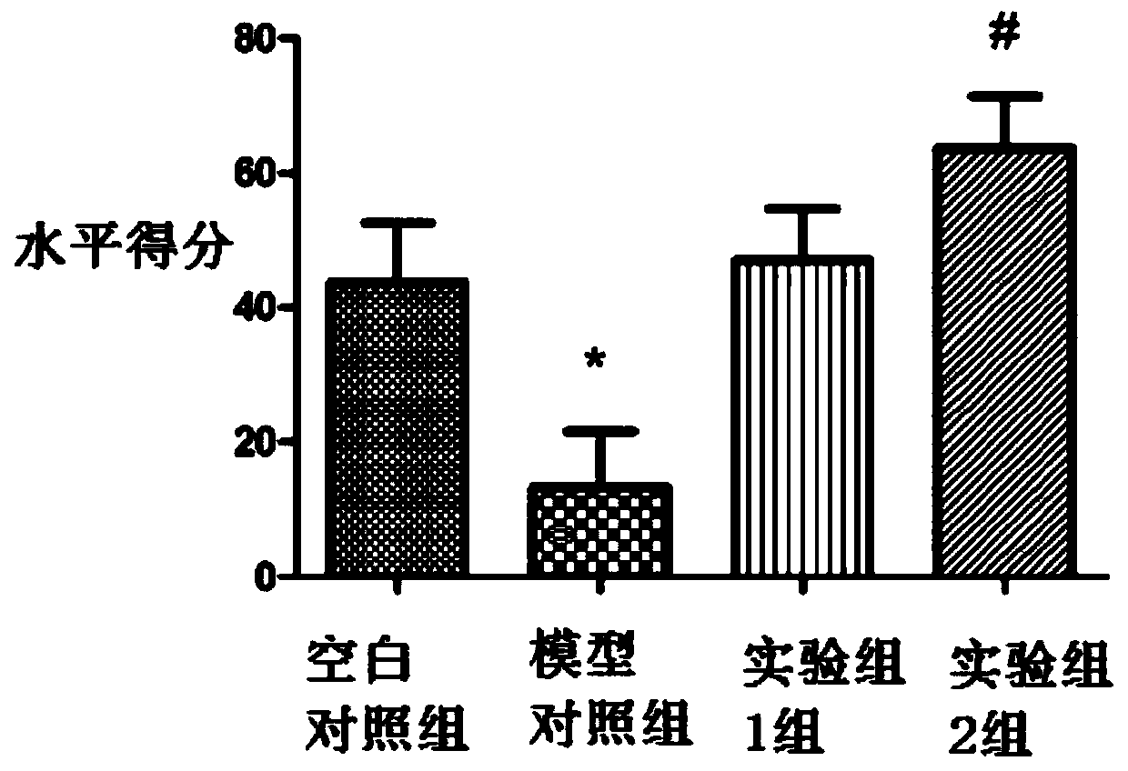 Application of nadph in the preparation of anti-anxiety drugs