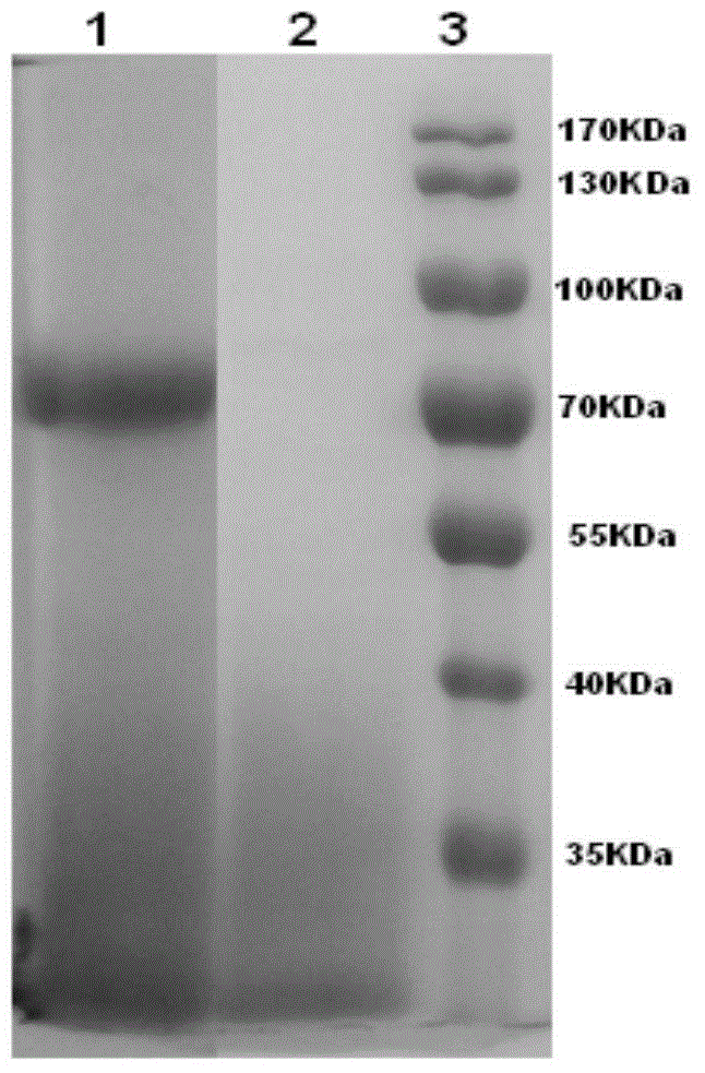 Phosphatidase, coding gene, preparation method and application thereof