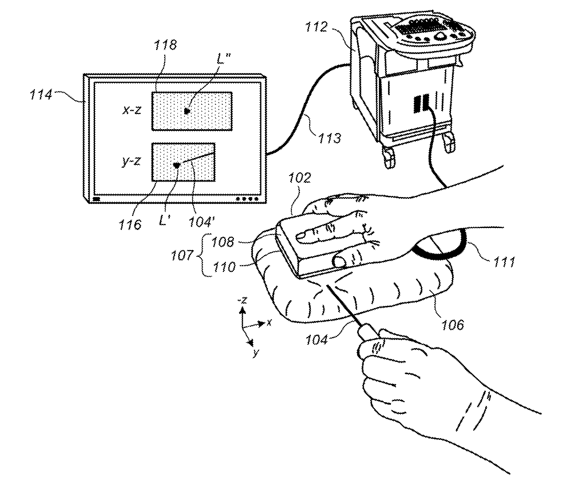 Handheld volumetric ultrasound scanning device