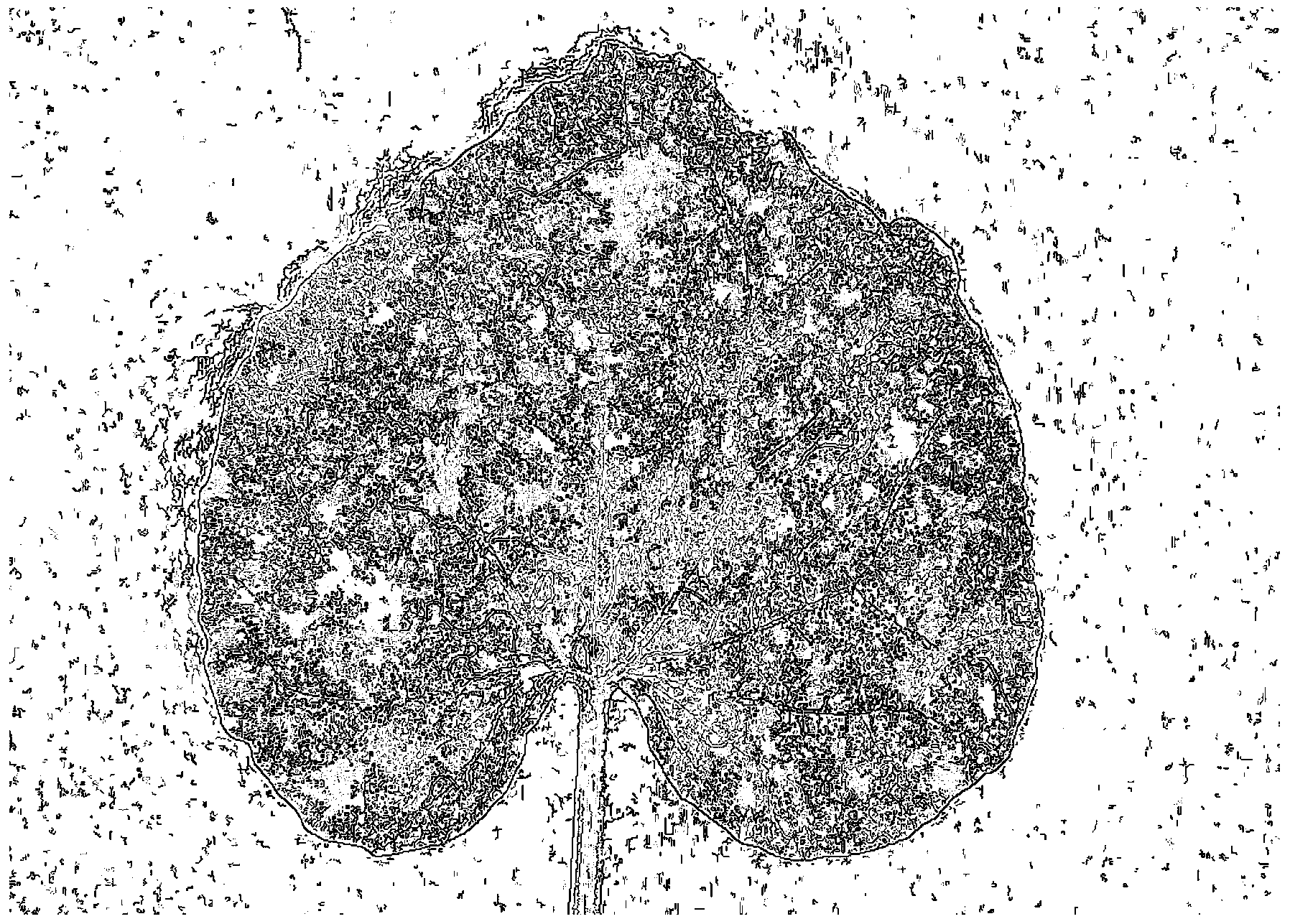 Method and system for acquiring disease severity of leaf under open field environment