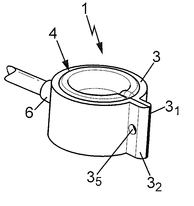 Adjustable vascular ring, means for treating SFS syndrome and implantable kit comprising such a ring, mould and method for obtaining such a ring