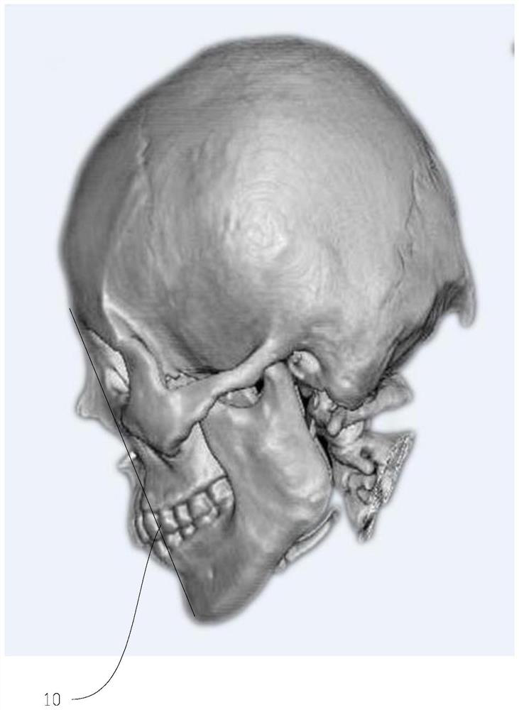 Skull slicing method, storage medium and electronic equipment