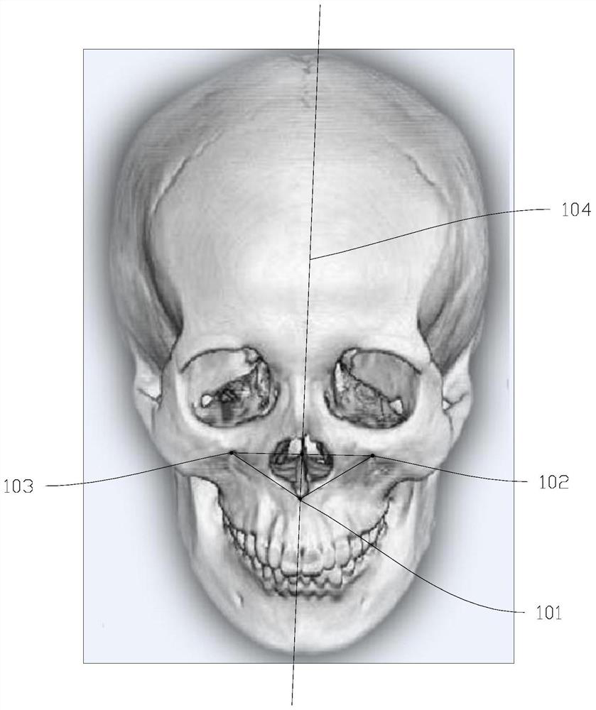 Skull slicing method, storage medium and electronic equipment