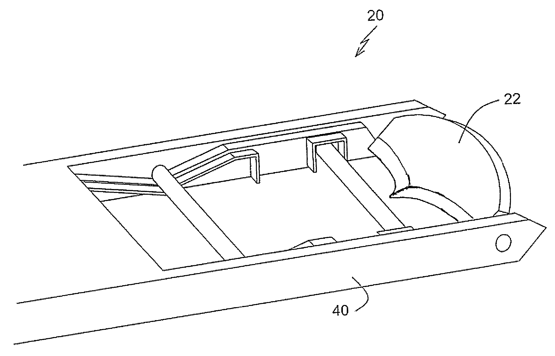 Surgical tool and method for extracting tissue from wall of an organ