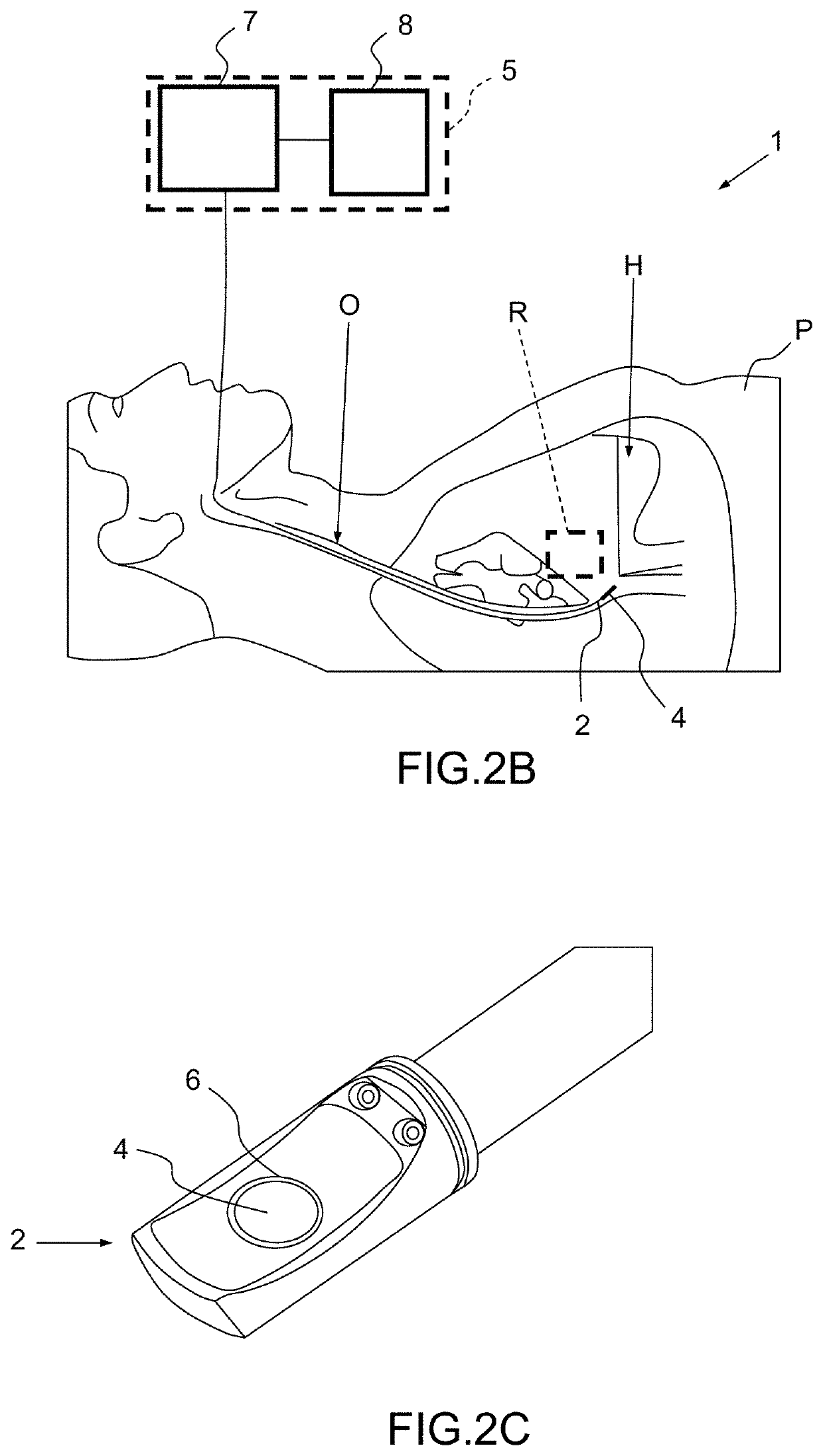 Method and apparatus for treating valvular disease