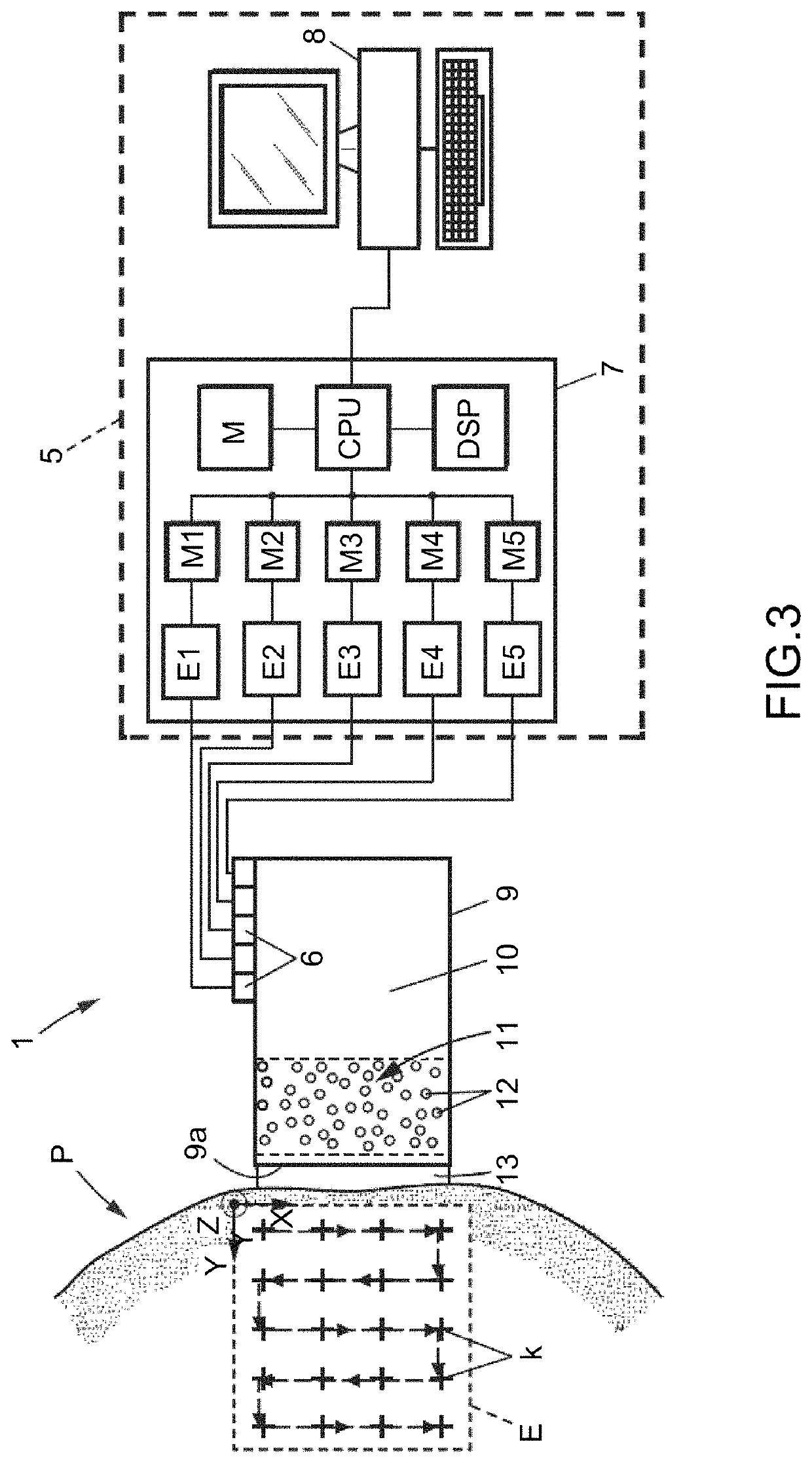 Method and apparatus for treating valvular disease