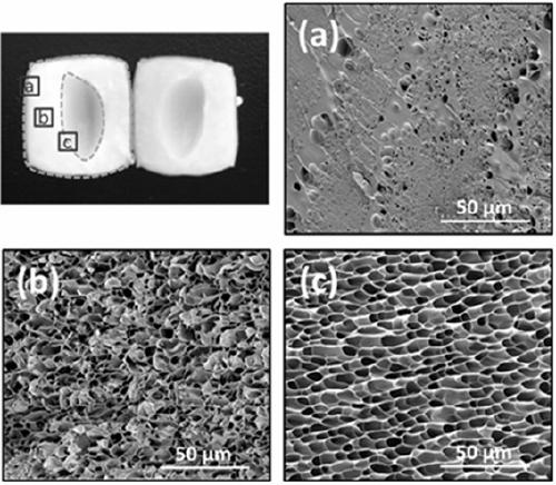 Protein hydrogel with gradient structure and preparation method thereof