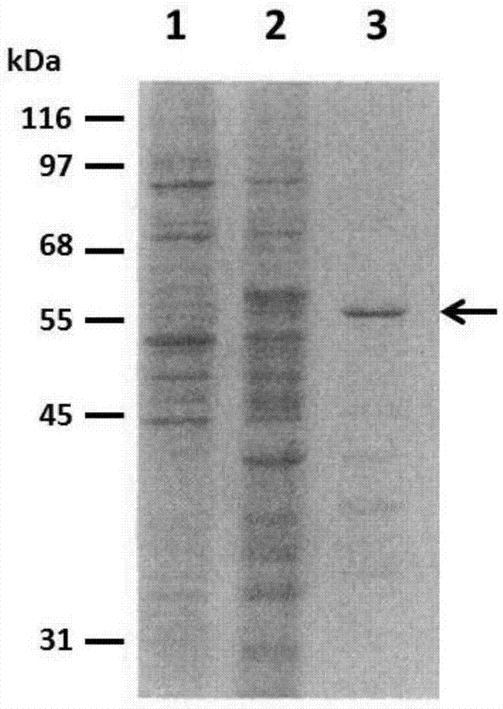 Anti-human papilloma virus L1 protein antibody, and coding gene and application thereof