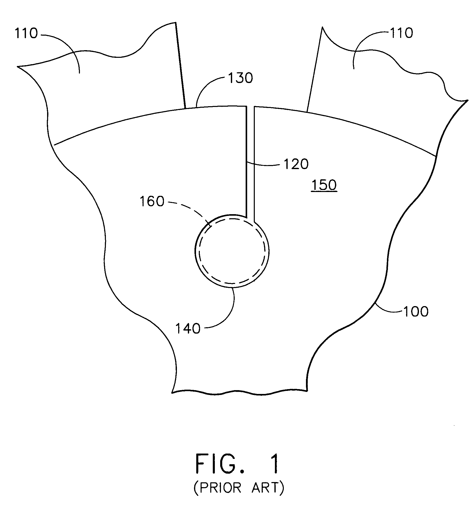 Hoop stress relief mechanism for gas turbine engines