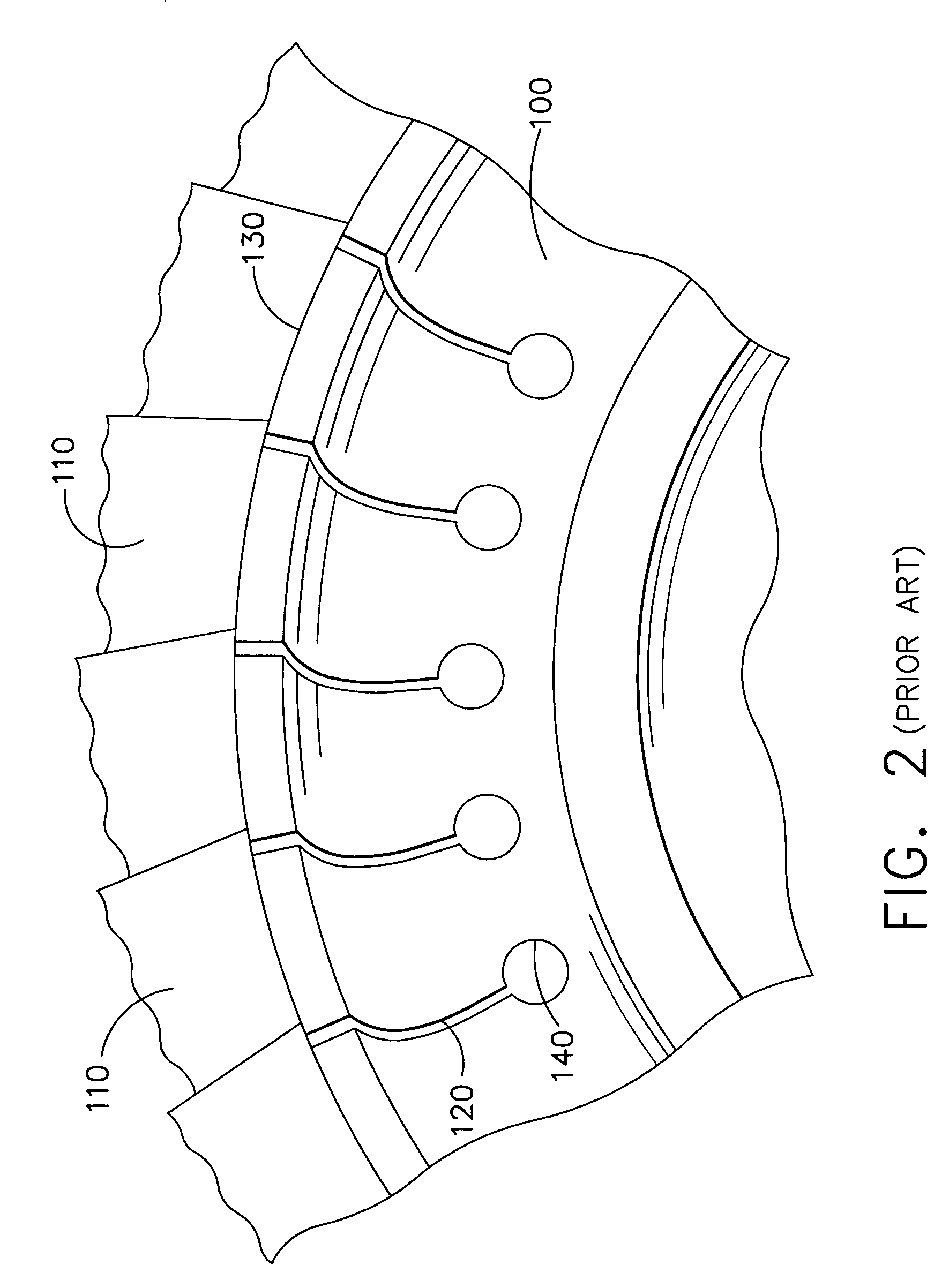 Hoop stress relief mechanism for gas turbine engines