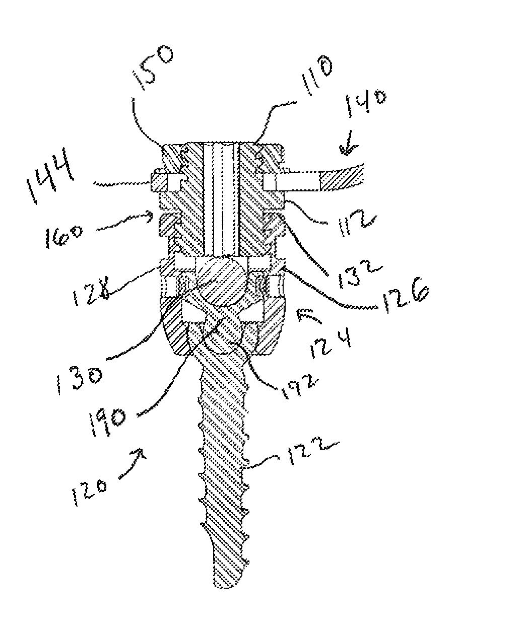 Vertebral fixation system including torque mitigation